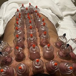 Mei Kang Health Center - 拔罐好处，袪湿减肥通经络活血等......