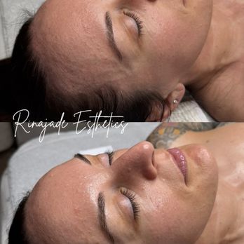 Rinajade Esthetics - Glow Up Signature Facial - Hair Removal Near Me - Roseville, California Rinajade Esthetics - Glow Up Signature Facial - Hair Removal Near Me - Roseville, California