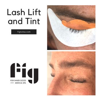 Fig Medical Spa - Tulsa - Now that's a lash lift! Tired of lash extensions? Come see us for a lash lift and tint! - Medical Spas Near Me - Tulsa, Oklahoma