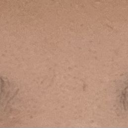 My right eyebrow is fine. My left eyebrow is so obviously uneven and they couldn't fix it.