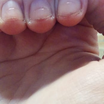 ProTop Nails - The filed lines across my nail beds are deep enough to see and feel. - Nail Salons Near Me - Roseville, California