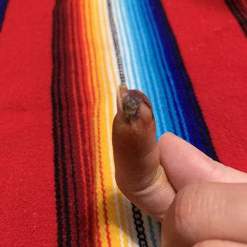 Diva Nails - After 2nd Surgery - Nail Salons Near Me - Chula Vista, California