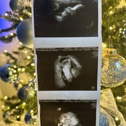 Next Generation Prenatal Imaging - Baby's foot!