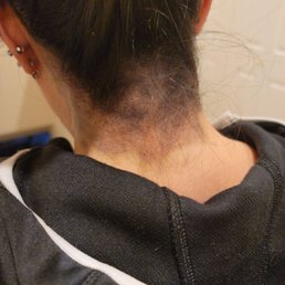 Dye on my neck and side of my neck!! Dye on my neck and side of my neck!!