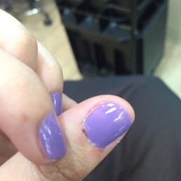 They superglued the thumb cuticle where they made me bleed.