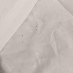 Bayside Inn & Waterfront Suites - More bedbug splotches