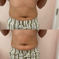 The Beauty Tender - Body Sculpting