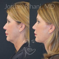 Facial Plastic Surgery Institute
