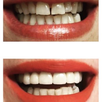Summy Abbassi, DDS - Cosmetic Dentists Near Me - Tarzana, California