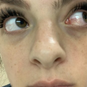 MegaLash Studio - Eyelash Service Near Me - Downers Grove, Illinois