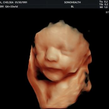 Sonohealth - Ultrasound Imaging Centers Near Me - San Diego, California Sonohealth - Ultrasound Imaging Centers Near Me - San Diego, California