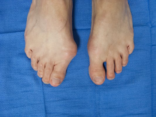 GLENN PFEFFER, MD - CEDARS SINAI ORTHOPEDIC CENTER - Updated March 2026 ...