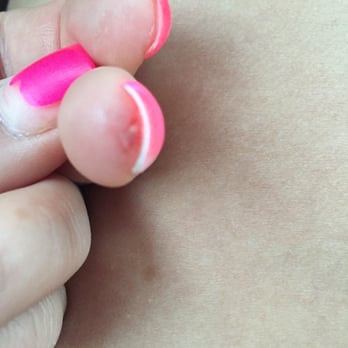 TD Nails & Spa - Puss and blood to go along with my unfinished nails. Thanks TD Nails - Nail Salons Near Me - Grand Forks, North Dakota TD Nails & Spa - Puss and blood to go along with my unfinished nails. Thanks TD Nails - Nail Salons Near Me - Grand Forks, North Dakota