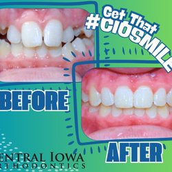 Central Iowa Orthodontics