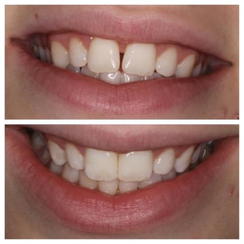 Robinson Township Smiles - Endodontists Near Me - Coraopolis, Pennsylvania