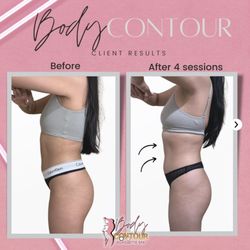 The Body Contour Spa