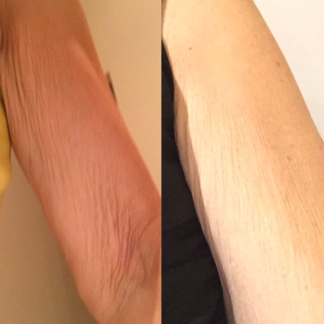 Endermologie By Nathalie Paradis Logo