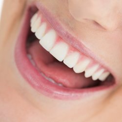 Advanced Family Dental by Espire - Teeth whitening services in Lakewood, CO