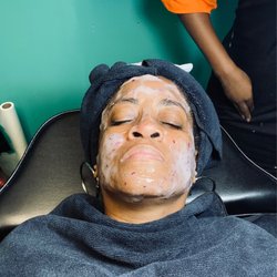EnerU Esthetics - The peeling mask after the dermaplaning.