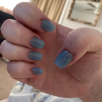 Serenity Nails & Spa - You can see the scabs from where she cut my cuticles too much. - Massage Near Me - Glen Burnie, Maryland Serenity Nails & Spa - You can see the scabs from where she cut my cuticles too much. - Massage Near Me - Glen Burnie, Maryland