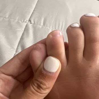 Minty Nail & Spa - two toes with chipped paint - Nail Salons Near Me - Franklin Square, New York