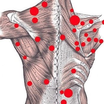 AVEN DEEP | Structural Massage - Trigger Point Neuromuscular Therapy & Orthopedic Tui Na - Massage Near Me - Seguin, Texas AVEN DEEP | Structural Massage - Trigger Point Neuromuscular Therapy & Orthopedic Tui Na - Massage Near Me - Seguin, Texas