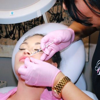 Posh Facial Esthetics - Our nurse injector Stephanie is one of the best! - Medical Spas Near Me - Rochester, Minnesota Posh Facial Esthetics - Our nurse injector Stephanie is one of the best! - Medical Spas Near Me - Rochester, Minnesota