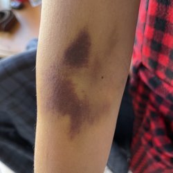 Quest Diagnostics - Six days after the blood drawn