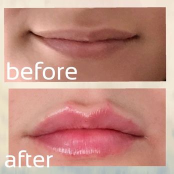 Lazer Lounge - Laser Hair Removal Near Me - Studio City, California Lazer Lounge - Laser Hair Removal Near Me - Studio City, California
