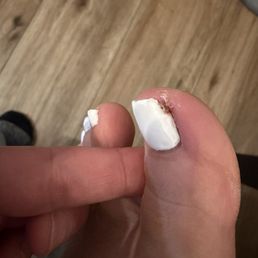 They fucked up my toe it's hurts so bad ,I couldn't really walk today I got a pedi done yesterday . I will never go back They fucked up my toe it's hurts so bad ,I couldn't really walk today I got a pedi done yesterday . I will never go back