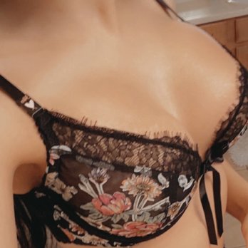 Eugene Kim, MD - 2nd surgery October 20. I am now 1 week post op- 400 CCs Breast augmentation, now a D cup! love it - Cosmetic Surgeons Near Me - Beverly Hills, California Eugene Kim, MD - 2nd surgery October 20. I am now 1 week post op- 400 CCs Breast augmentation, now a D cup! love it - Cosmetic Surgeons Near Me - Beverly Hills, California