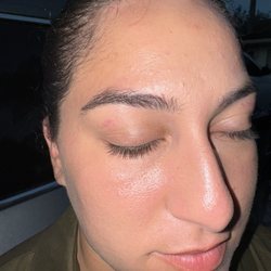 Rapid Wax - You can see the skin that has been ripped off from beneath my eyebrows.