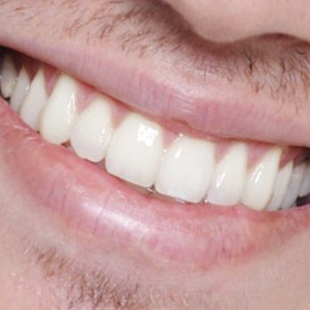 Orly Taitz, DDS - General Dentistry Near Me - Rancho Santa Margari, California