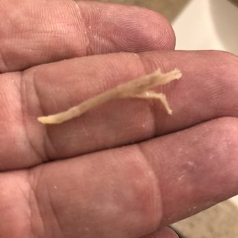 Highlands Hospital - The bone the doctor didn't see on the scan that was lodged in my husband's throat. He was a ent home and started choking again. - Hospitals Near Me - Connellsville, Pennsylvania Highlands Hospital - The bone the doctor didn't see on the scan that was lodged in my husband's throat. He was a ent home and started choking again. - Hospitals Near Me - Connellsville, Pennsylvania