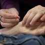 Yunker Acupuncture