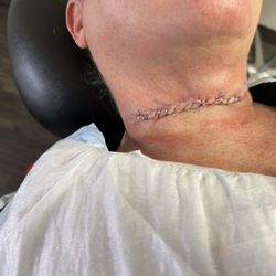 Beatrice Keller Clinic Goodyear - The beautiful job she did once the melanoma was removed