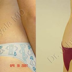 Ayala Plastic Surgery - John Ayala, MD - Plastic Surgeons in San Antonio, TX