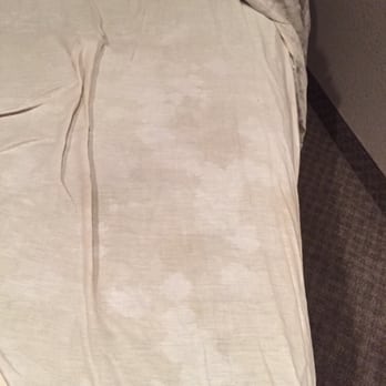 Advanced Physical Medicine - These were the sheets BEFORE the massage!!! - Weight Loss Centers Near Me - Arlington, Texas Advanced Physical Medicine - These were the sheets BEFORE the massage!!! - Weight Loss Centers Near Me - Arlington, Texas