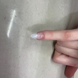 brown area is mold from cheap acrylic. brown area is mold from cheap acrylic.