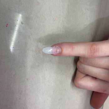 Top 10 Nails - brown area is mold from cheap acrylic. - Nail Salons Near Me - Independence, Missouri Top 10 Nails - brown area is mold from cheap acrylic. - Nail Salons Near Me - Independence, Missouri