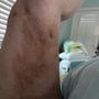 Vein Specialists