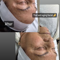 Devolt Esthetics
