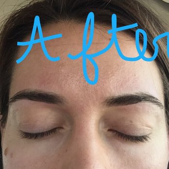 Sthree Skin Care - After! - Laser Hair Removal Near Me - Centreville, Virginia Sthree Skin Care - After! - Laser Hair Removal Near Me - Centreville, Virginia