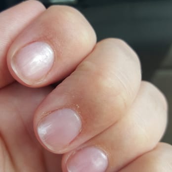 Tip to Toe Nails - Bubbles in the polish, chipping sfter one day, and cuticles are rough. - Nail Salons Near Me - Denver, Colorado Tip to Toe Nails - Bubbles in the polish, chipping sfter one day, and cuticles are rough. - Nail Salons Near Me - Denver, Colorado