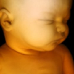 Peek a View Ultrasound - Peekaviewultrasound.com