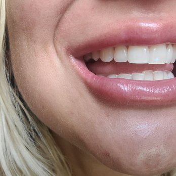 Pearly Whites - Teeth Whitening Near Me Pearly Whites - Teeth Whitening Near Me