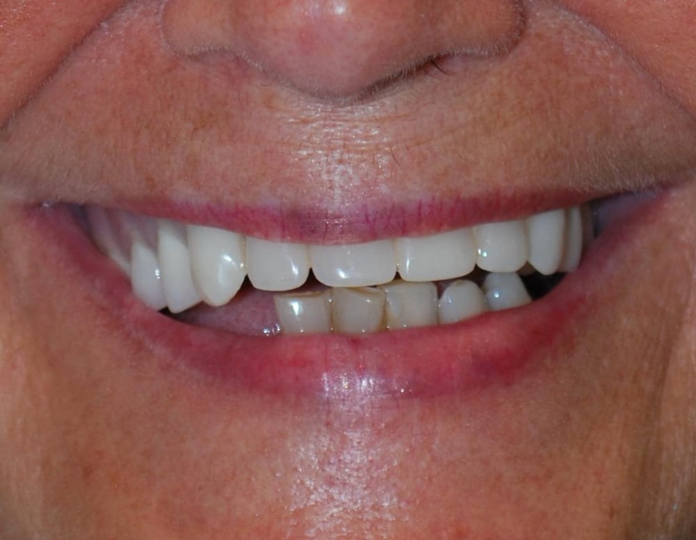 FOURNIER DENTURIST CLINIC Updated September 2024 2911 Laurier