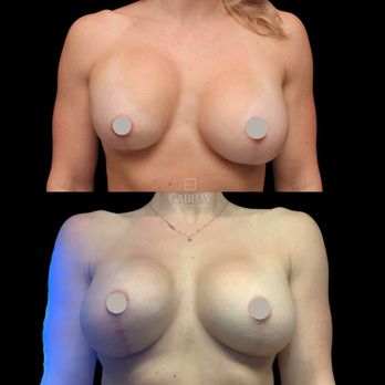 Gabbay Plastic Surgery - Cosmetic Surgeons Near Me - Beverly Hills, California Gabbay Plastic Surgery - Cosmetic Surgeons Near Me - Beverly Hills, California