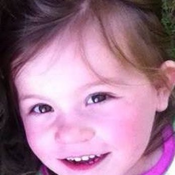 Kids Dental Care - Before they killed her tooth - Pediatric Dentists Near Me - Bristol, Connecticut