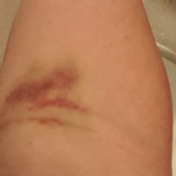 Quest Diagnostics - 5 days after blood draw! - Laboratory Testing Near Me - Millbrae, California